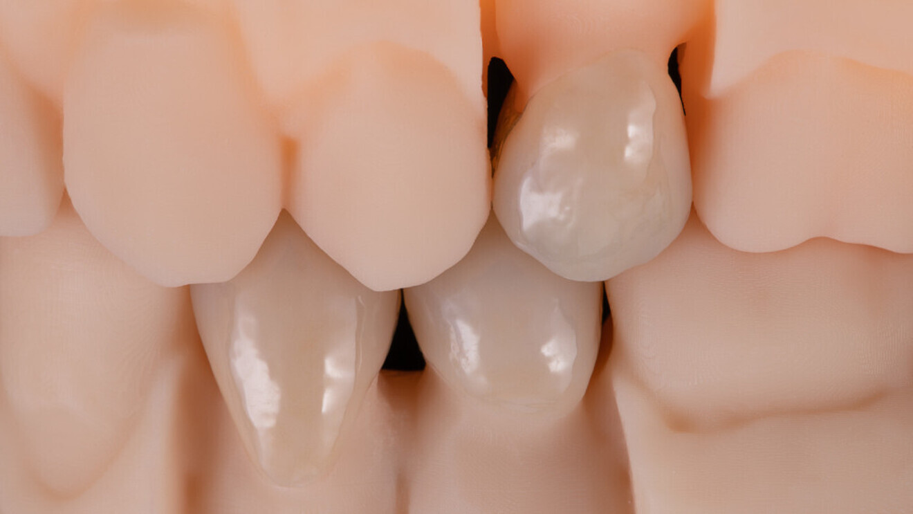 Fig. 14: Harmonious naturalness and a radiantly warm liveliness from the inside out, achieved in a very short production time.