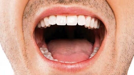 Oralne bakterije mogu biti odgovorne za infekcije koje se prenose hranom