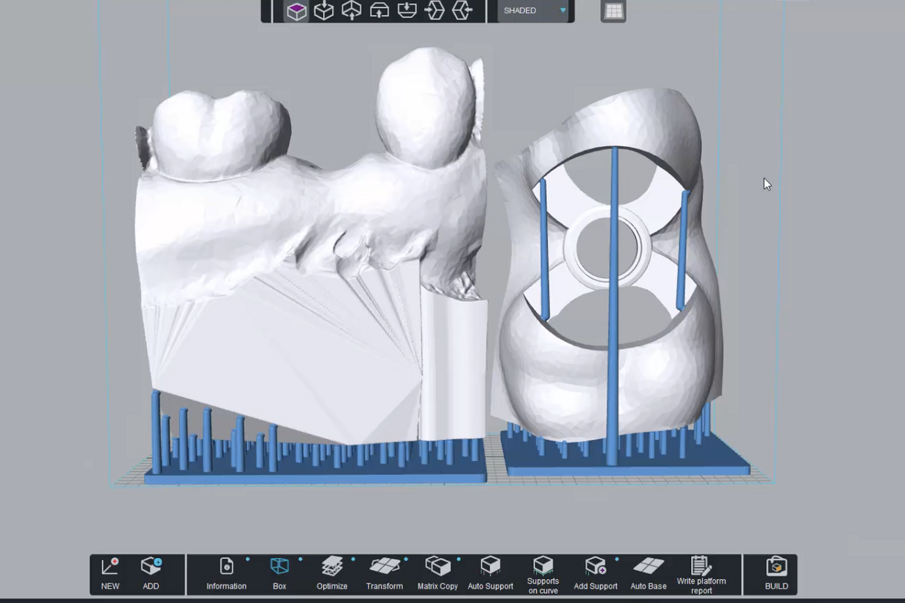 Fig. 10a_Il modello protesico e la dima chirurgica pronti per la stampa con DFAB.