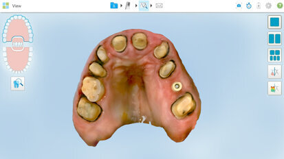 A game-changer in digital restorative dentistry