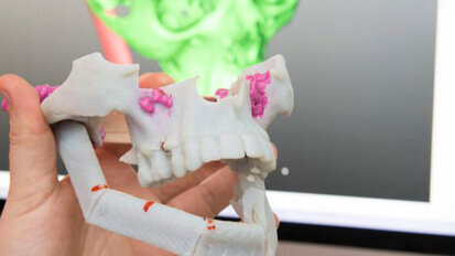Un congresso internazionale discute le potenzialità della stampa in 3-D in Medicina