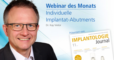 Webinar zu individuellen Implantatabutments mit Dr. Kay Vietor