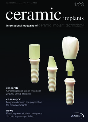 ceramic implants international No. 1, 2023 ceramic implants international No. 1, 2023