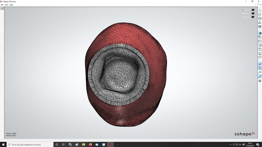 Fig. 15_Medesima visione algoritmica nella connessione interna determinata dalla conformazione del moncone implantare. Tale matematica è stata indicata nella libreria del software di progettazione direttamente dalla casa implantare.