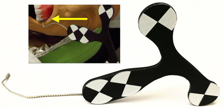 Fig. 6: (1) The Jaw-Tracker is installed. (2) During tracing, the system presents the percentage sampled up to 100 %.