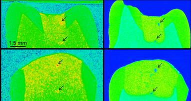 Zubereitung bei Zahnfüllmaterialien entscheidend