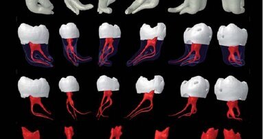 La parusia endodontica. Non parole, ma fatti