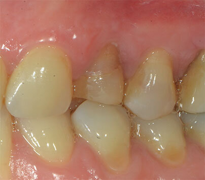 Fig. 2_Elemento 24 deve essere sostituito con impianto.
