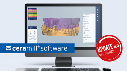 Amann Girrbach optimiza todo el software de Ceramill