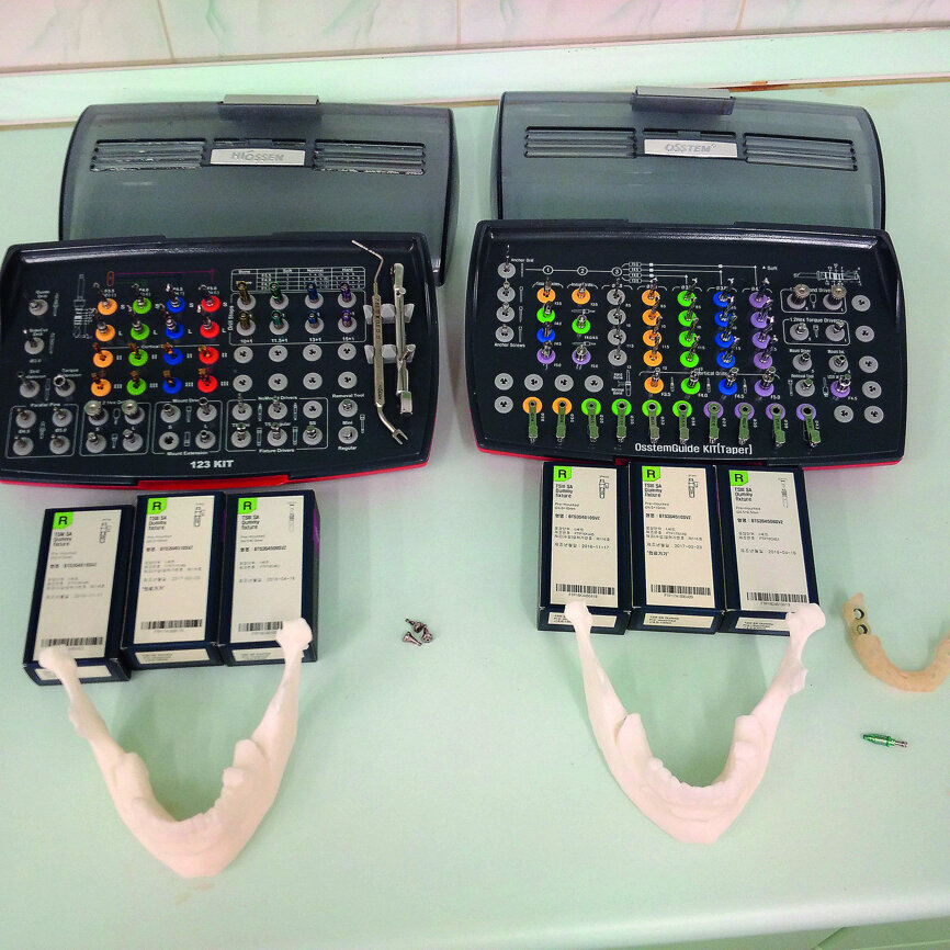 Fig. 2: Exemplary pair of models before the procedure: on the left, without the guide, and on the right, with the guide.