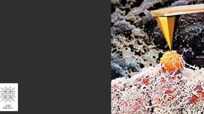 Uni Basel: Brustkrebs auf der Spur