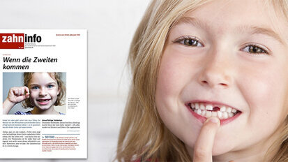 Zahninfo widmet sich dem Thema Wechselgebiss Zahninfo widmet sich dem Thema Wechselgebiss