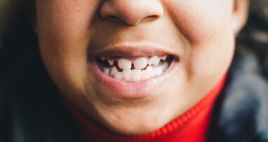 Cruciale rol voor ouders bij gezond houden kindergebitten