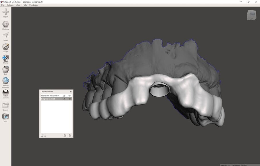Fig. 9_Disegno della dima chirurgica, visione prospettica.