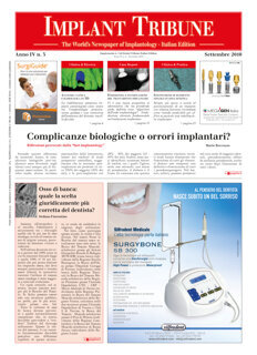 Implant Tribune Italy