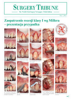 Surgery Tribune Poland No. 1, 2015