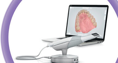 Intra-orale scanner cara TRIOS