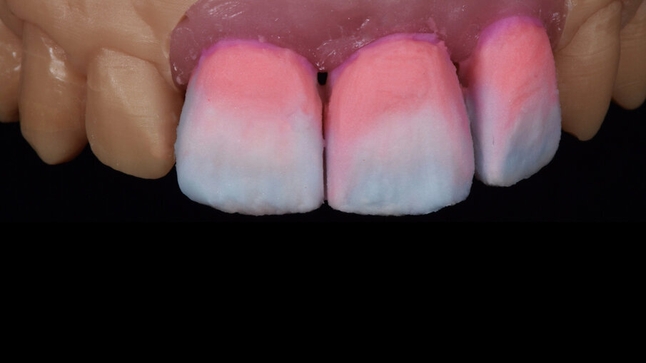 Fig. 10_Build-up smalti.