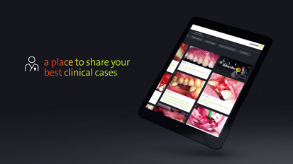 Straumann - youTooth Straumann - youTooth