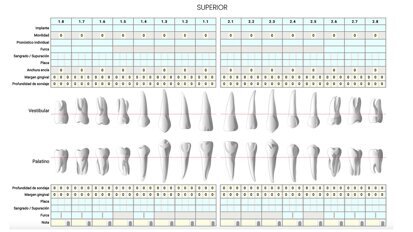 Un periodontograma para prevenir enfermedades de las encías