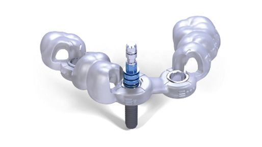 Straumann Guided Surgery