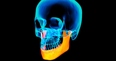 Primo trapianto di mandibola artificiale in Italia