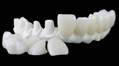 MAGICAL All on FOUR: chirurg, zubní lékař a zubní technik představují svůj unikátní postup