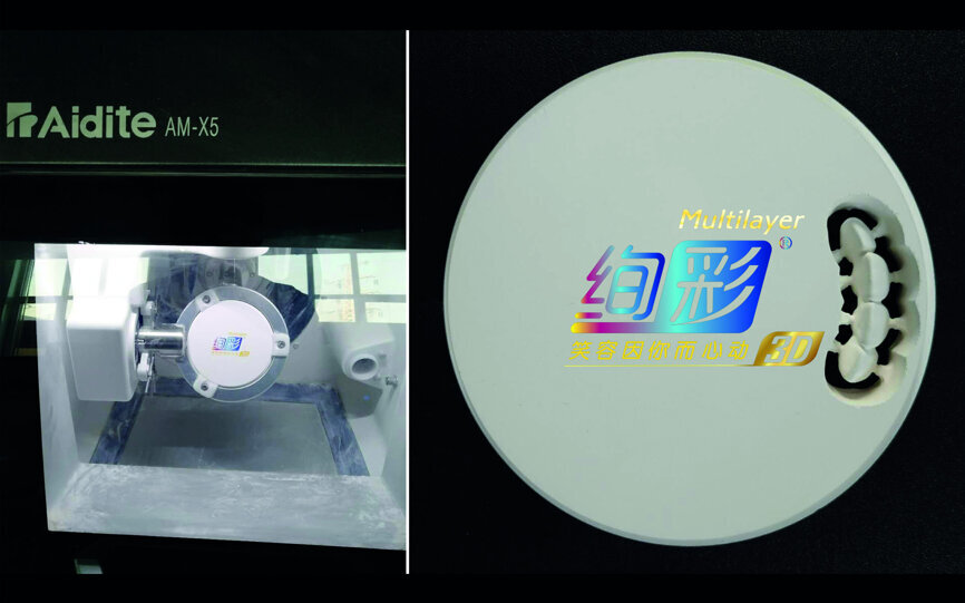 Fig. 39: Manufacture of the restoration with multilayer zirconia.