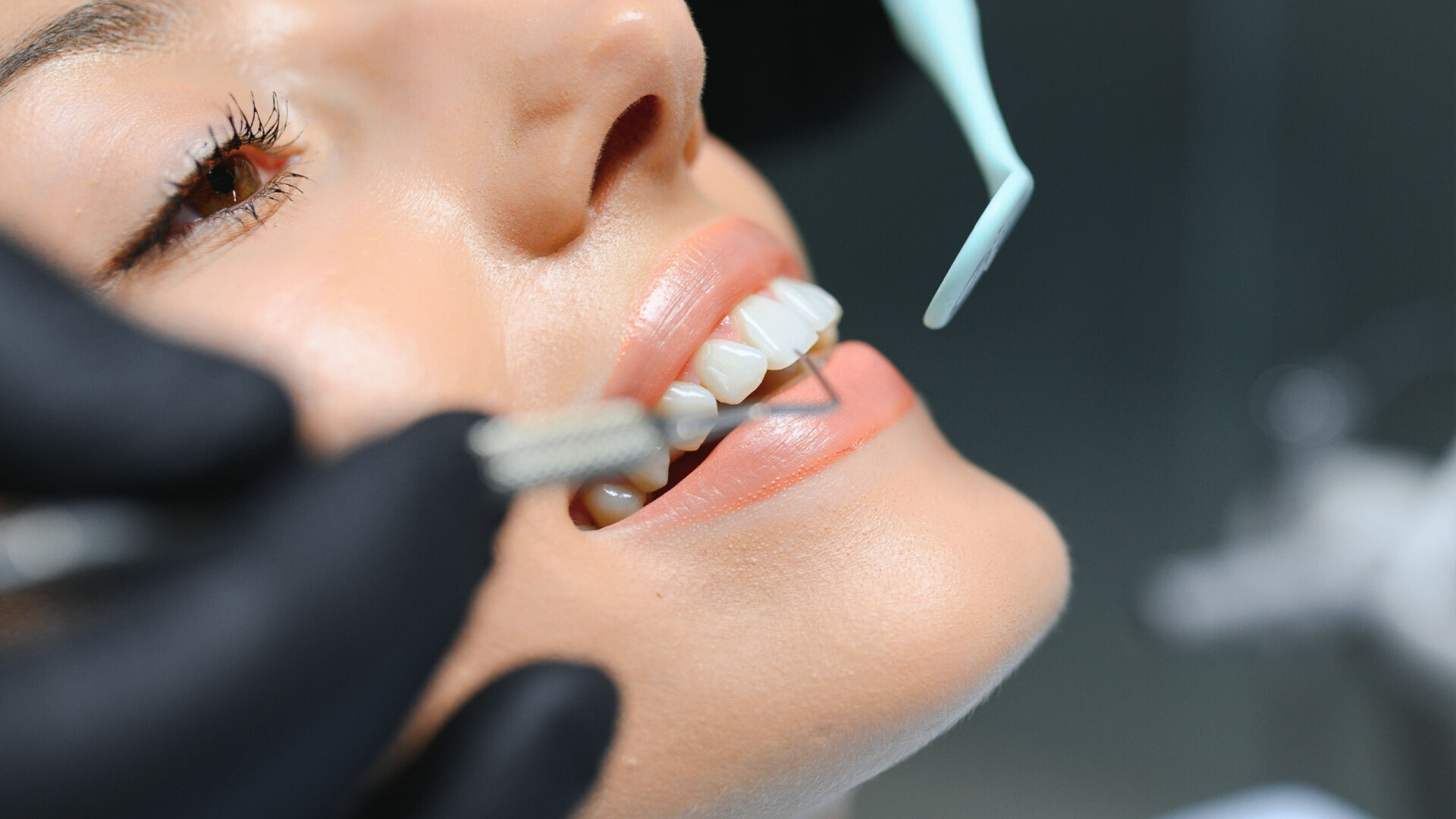 MiCD Fiber Filling: 4R protocol and applications