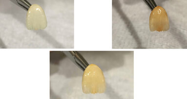 Las tres etapas de los dientes: Inocencia, madurez y sabiduría (2)