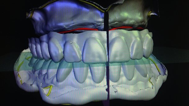 Value chains being transformed by new digital dental technologies