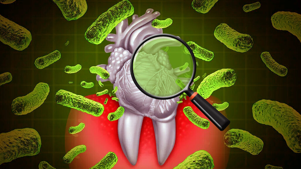 Study explores link between tooth brushing, heart diseases