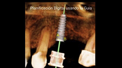 El odontólogo debe detectar precozmente las enfermedades de sus pacientes
