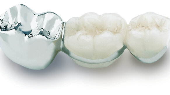 Aurident marks 35 years of making alloys