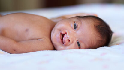 Study finds cleft lip caused by genes and environment