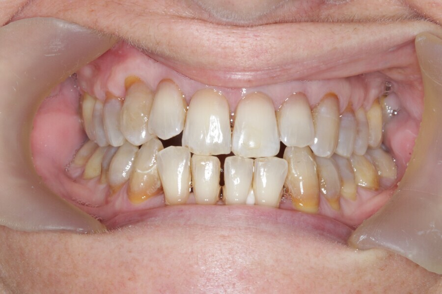 Fig. 36: Case ready to scan and submit to Reveal.