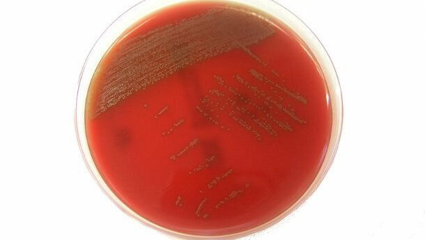 Une bactérie sur les muqueuses buccales pourrait provoquer des maladies graves si elle passe dans le sang