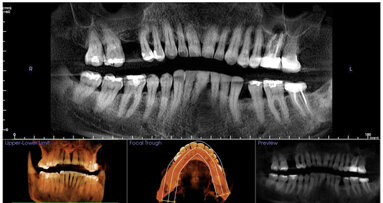 Una herramienta diagnóstica esencial