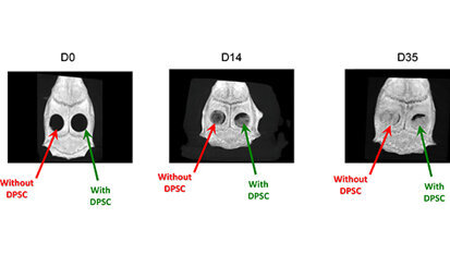 La fondation des «Gueules Cassées » organise une journée scientifique, Sourire quand même