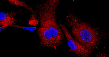 Le cellule staminali una via possibile per rigenerare i denti perduti?