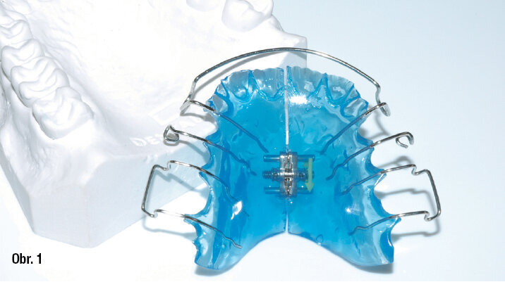 Aparát z Orthocryl LC