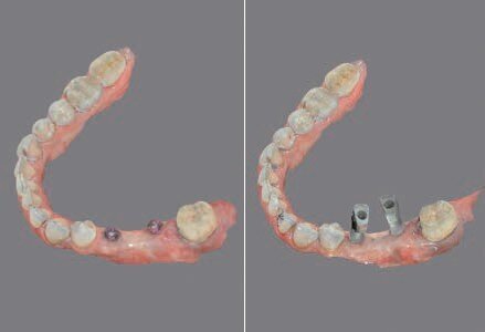 Fig. 15 - Impronte digitali.