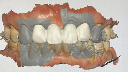 Digitalisation for the conventional and analogue dentist: Ten key points