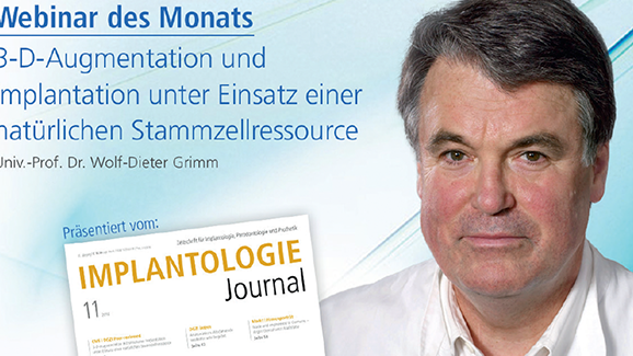 3-D-Augmentation und Implantation mit einer Stammzellenressource