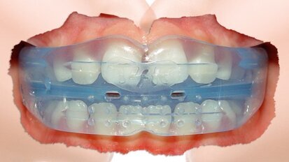 Una ortodoncia divertida