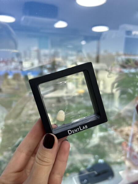 Patented delivery box used at DentLab to prevent loss of items. 