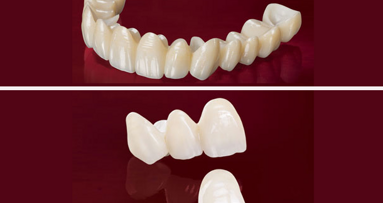 Los avanzados productos de zirconia de Glidewell ya están en Latinoamérica