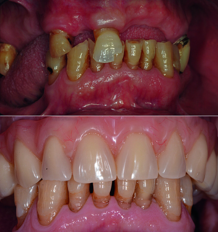 Confronto pre e post trattamento