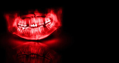 Primeiro estudo longitudinal investiga a relação entre saúde bucal e doença renal