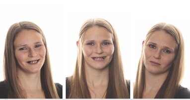 Una nueva sonrisa para Andrea